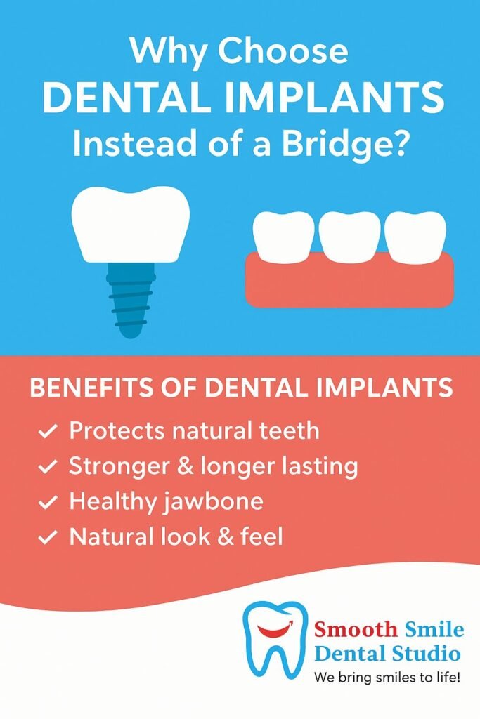 Why Choose Dental Implants Instead of a Bridge?